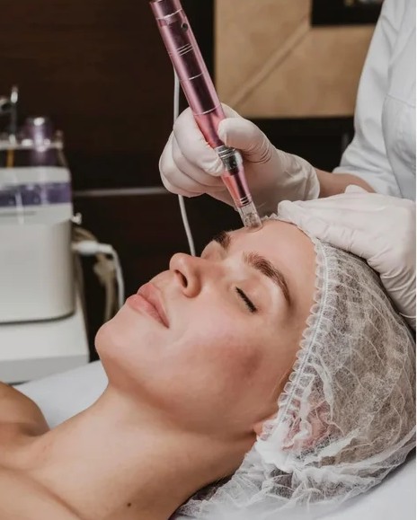Collagen Induction Therapy for Skin Firming