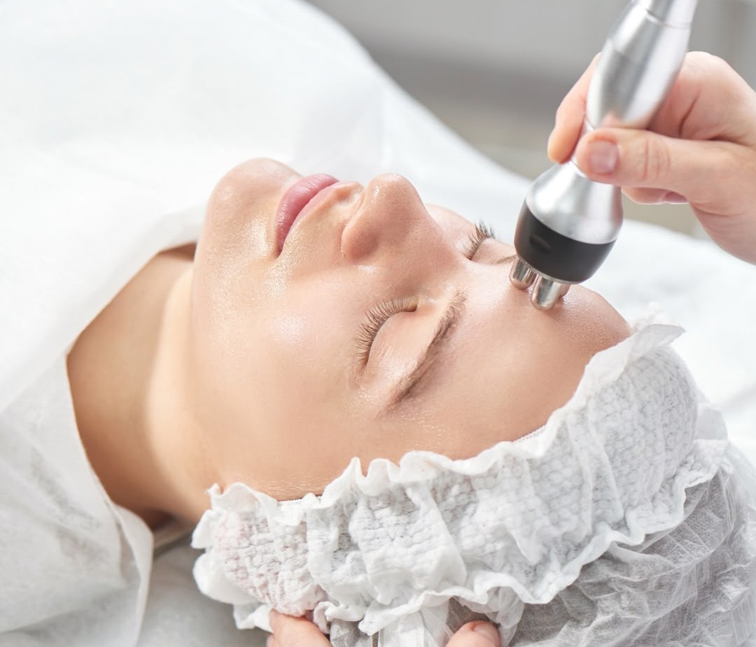 Radiofrequency Skin Tightening