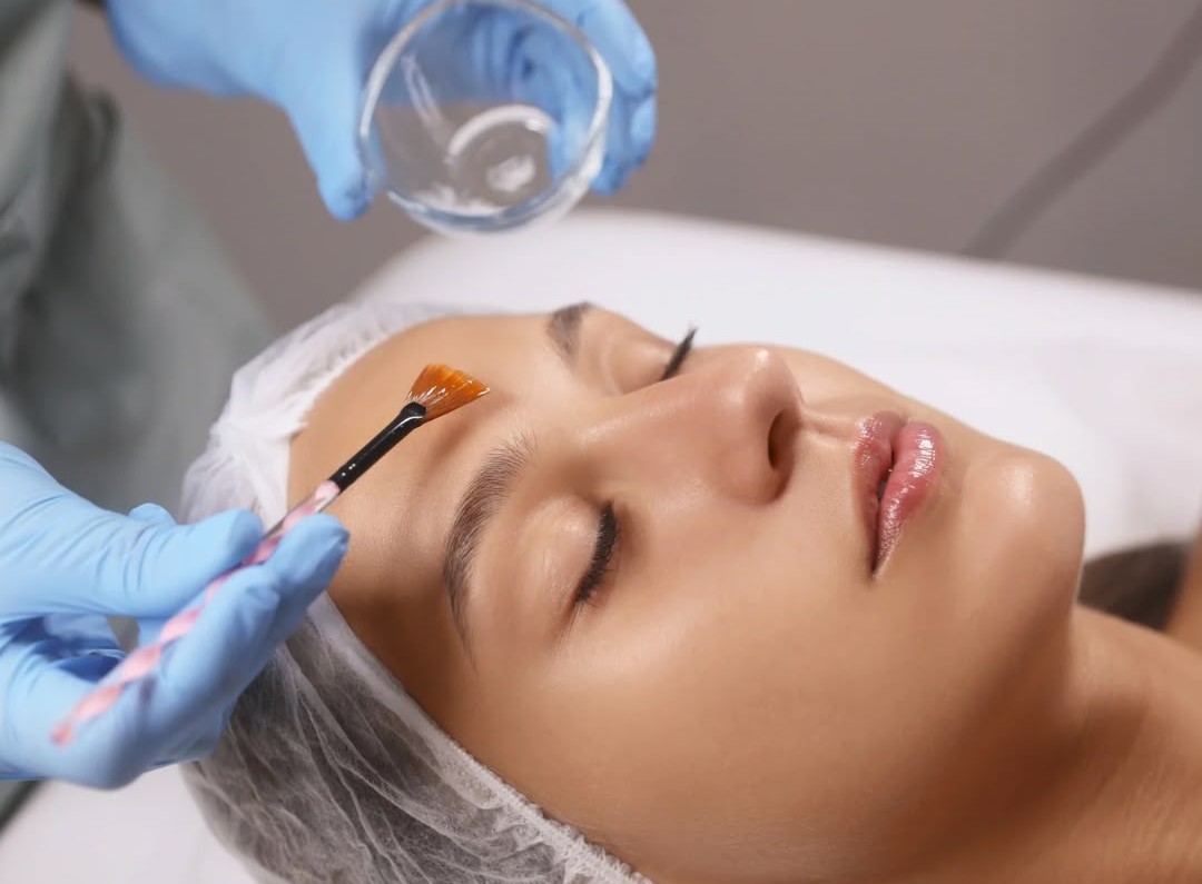 Customized Peel Treatments